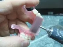 Ремонт протезів з поліпропілену, NewDental ремонт