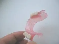 Ремонт протезів з поліпропілену, NewDental поліпропілену