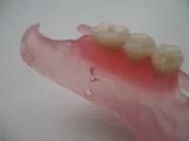 Ремонт протезів з поліпропілену, NewDental протезів