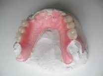 Ремонт протезів з поліпропілену, NewDental поліпропілену