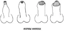 статеве