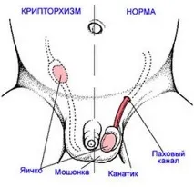 статеве