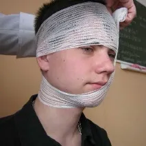 Пов’язка Вуздечка техніка накладання в картинках техніка