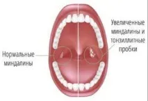 това