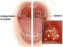 опасните