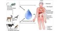 Головний біль та висока температура причини, лікування біль
