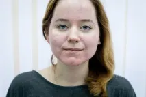 Як перемогти акне Частина 3 частина