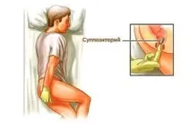 Кращі кровоспинні свічки від геморою при кровотечі - назви препаратів та відгуки кращі