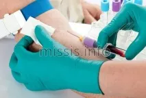 Норма феритину в крові у жінок, випадає волосся крові