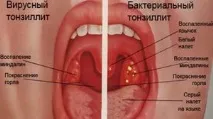 хронічного