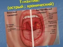 ознаки