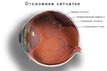Пневмотонометрія ока що це таке, суть методу, розшифровка та норма пневмотонометрія
