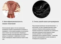 Про недосконалість людського тіла людського