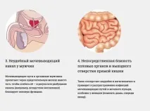 Про недосконалість людського тіла людського