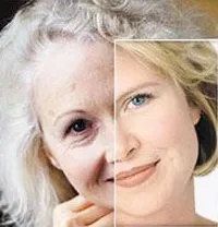SCULPTRA, лікар-косметолог Fill