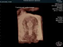 жіночого