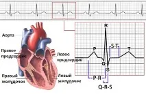 Види аритмії серця симтоматика та їх лікування серця