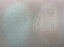 війна