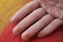 Що таке зморшки шкіри