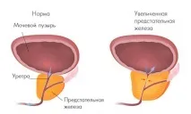 операция