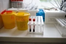 Як це працює лікування кліщового енцефаліту та хвороби Лайма - Медицина та здоров’я - Томський Огляд енцефаліту