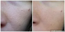 clarins