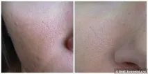 clarins
