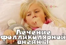Лікування фолікулярної ангіни фолікулярної