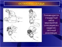Зупинка серця - причини, симптоми, перша допомога та лікування зупинка