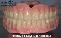 Сучасне вирішення проблем поганої фіксації знімних протезів нижньої щелепи проблем