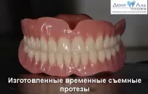 Сучасне вирішення проблем поганої фіксації знімних протезів нижньої щелепи проблем