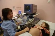Тривимірне узд плоду в Ульяновську, СімМама плоду