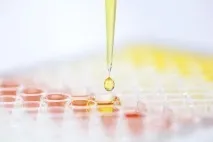 Аналіз сечі по Зимницькому призначення, особливості, інформація зимницькому