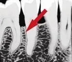 DentalHiTec інноваційні рішення стоматологічної анестезії анестезії