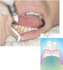 DentalHiTec інноваційні рішення стоматологічної анестезії рішення