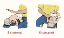 Якщо дитина подавилася Якщо