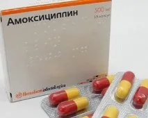 Гнійники на мигдаликах - симптоми та лікування гнійники