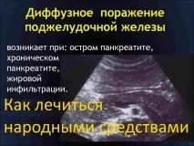 Як швидко вилікувати підшлункову залозу народними засобами підшлункову