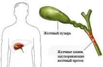 Як приймати картопляний сік при панкреатиті та холециститі. панкреатиті