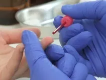Як стати донором покрокова інструкція Твоя Паралель покрокова