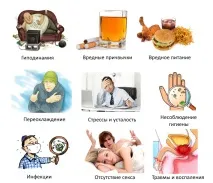 Камені у простаті причини освіти, симптоми та способи лікування простаті