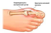 лікування