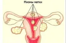 хворіти