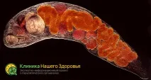 Плоскі черви (сисуни, трематоди) види, особливості та лікування види