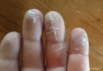 проблем