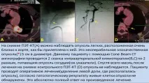 Інтервенційна радіологія в лікуванні онкологічних захворювань. радіологія