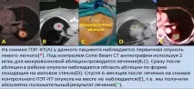 Інтервенційна радіологія в лікуванні онкологічних захворювань. радіологія
