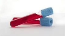 Зсув ліворуч лейкоцитарної формули зсув