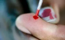 Зсув ліворуч лейкоцитарної формули ліворуч