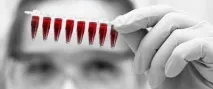 Зсув ліворуч лейкоцитарної формули формули